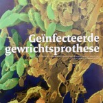 Stand van Zaken: Geïnfecteerde Gewrichtsprotheses